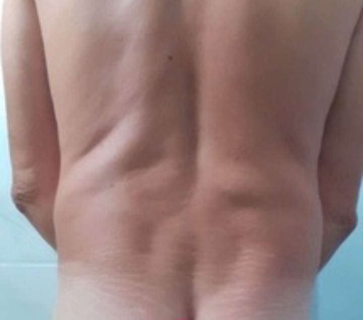 Profil de Benoni